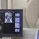 L'Italia è il primo paese in Europa per la cura del cancro. Lo rivela l'Associazione italiana di oncologia medica - L'Huffington Post