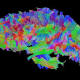 Mistero Déjà-vu, è anomalia cerebrale - ANSA.it