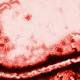 Ebola, ultime news: migliorano le condizioni del medico italiano ... - Blasting News