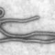 Ebola, realizzato un dispositivo per individuare il virus - Rai News