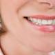 Addio dentista, dall'Australia arriva il super smalto al fluoro contro la carie - TGCOM
