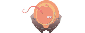 logo ivf